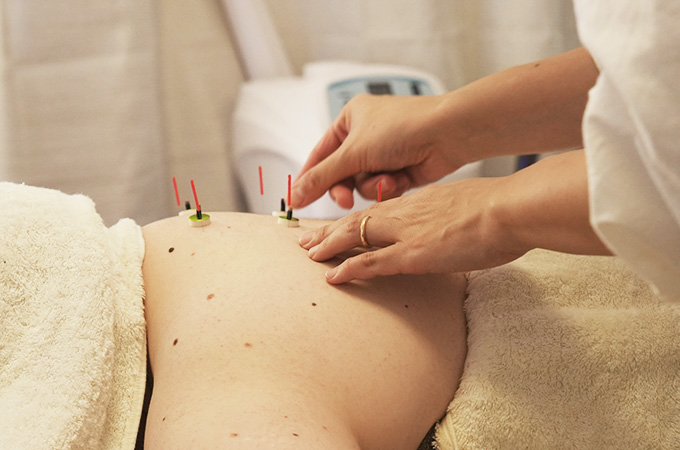 鍼灸